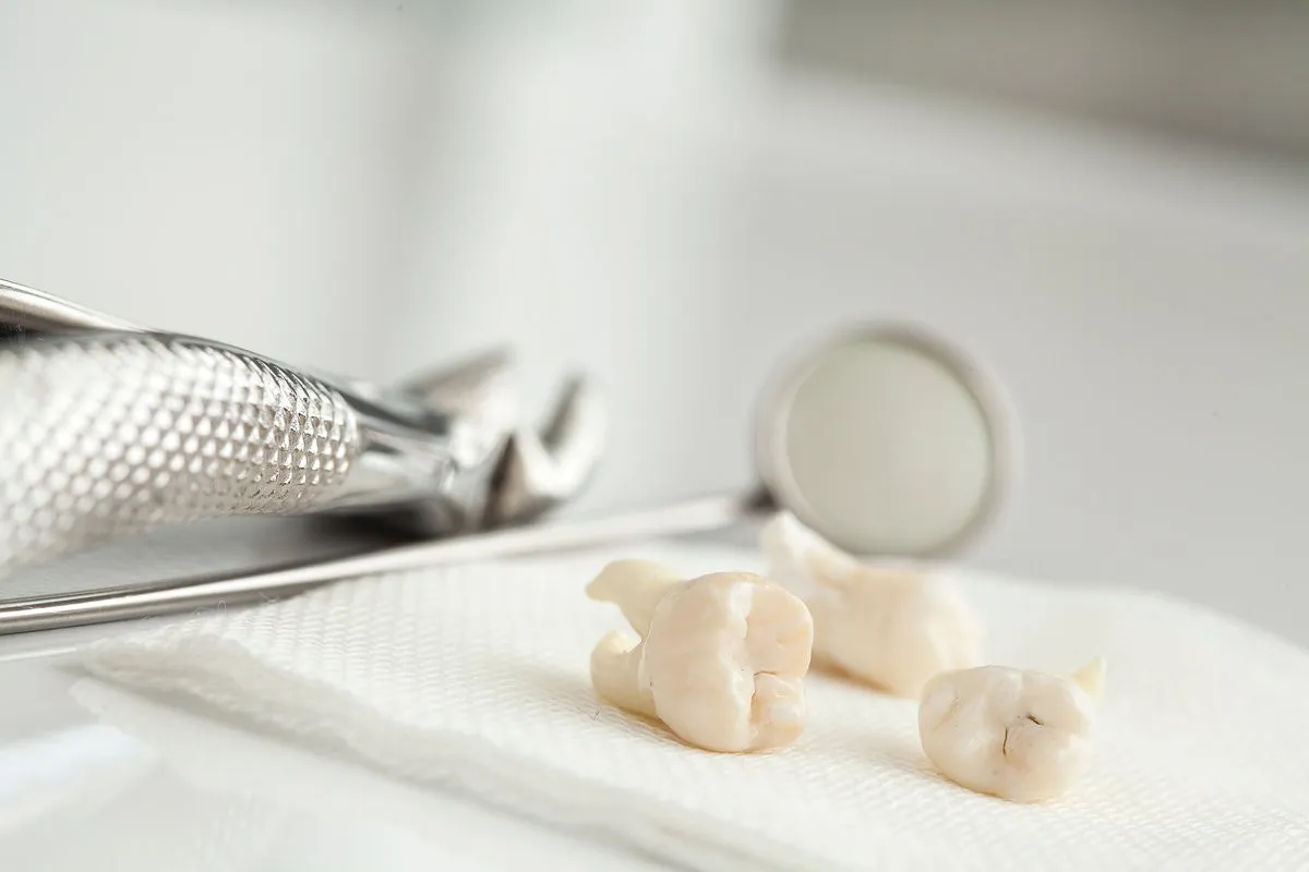 Couple smiling while looking at phone - Sunrise Dental Arts Care Extracted teeth on a dental surface