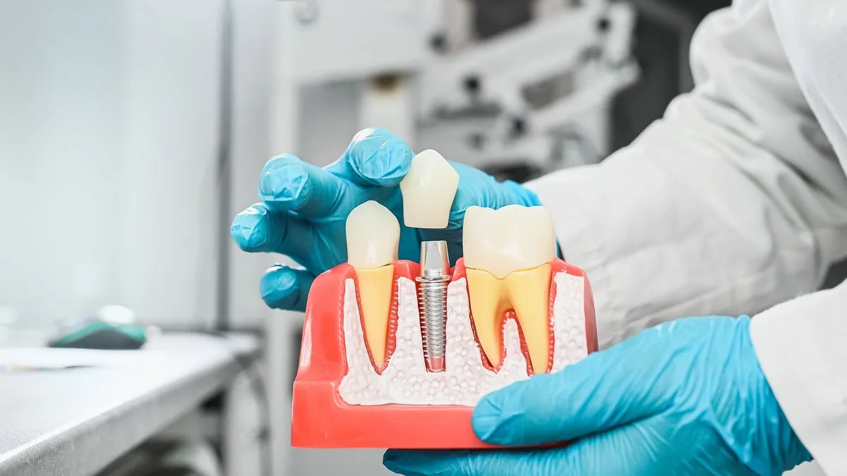 Man pointing at bright smile - Sunrise Dental Arts Care Implant crowns