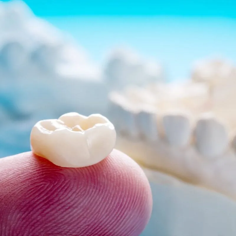 Closeup / Prosthodontics or Prosthetic / Single teeth crown and bridge equipment model express fix restoration.