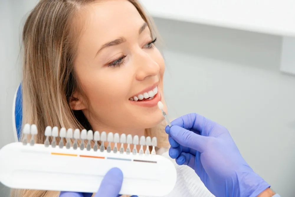 Woman choosing the shade of her porcelain veneers with a dentist
